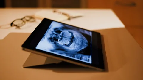 Doctor analyzing medical data on touchscreen computer Stock Footage 93622318