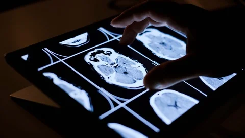 Doctor analyzing medical data on touchscreen computer Stock Footage 93622411