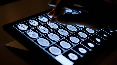 Doctor analyzing medical data on touchscreen computer Stock Footage 93622448