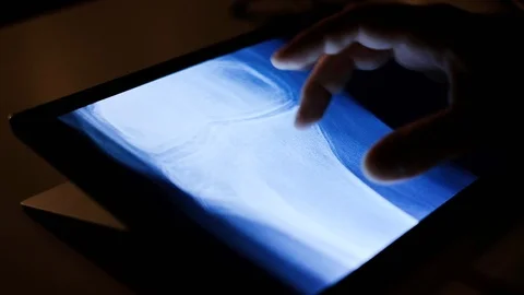 Doctor analyzing medical data on touchscreen computer Stock Footage 93622483
