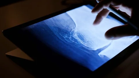 Doctor analyzing medical data on touchscreen computer Stock Footage 93622507