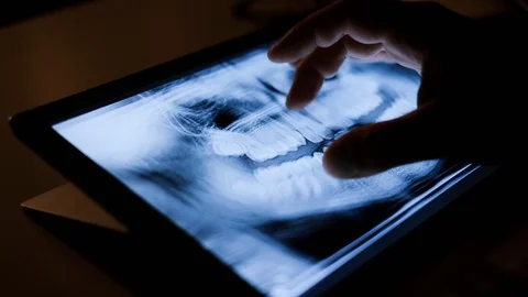 Doctor analyzing medical data on touchscreen computer Stock Footage 93622571