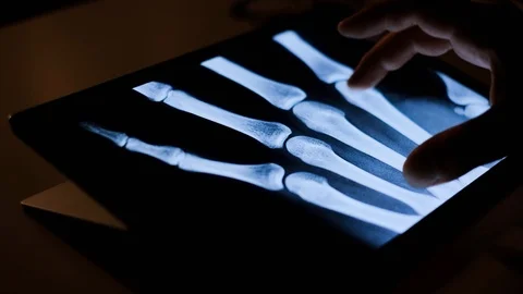 Doctor analyzing medical data on touchscreen computer Stock Footage 93622645