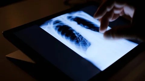 Doctor analyzing medical data on touchscreen computer Stock Footage 93622685