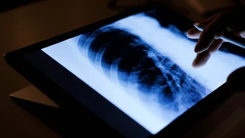 Doctor analyzing medical data on touchscreen computer Stock Footage 93622751