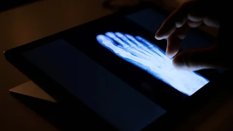 Doctor analyzing medical data on touchscreen computer Stock Footage 93622761