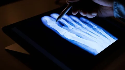 Doctor analyzing medical data on touchscreen computer Stock Footage 93622987