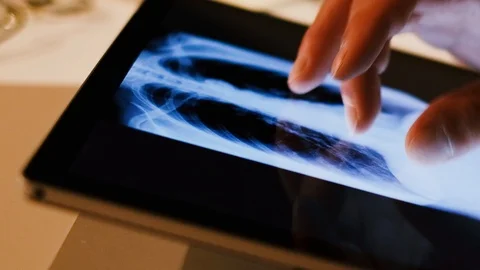 Doctor analyzing medical data on touchscreen computer Stock Footage 93623576