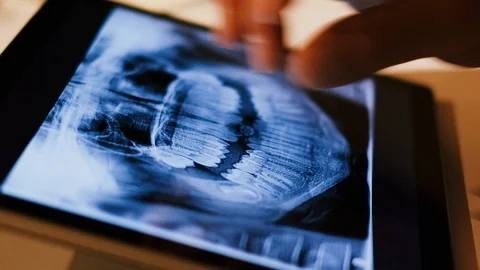 Doctor analyzing medical data on touchscreen computer Stock Footage 93623637