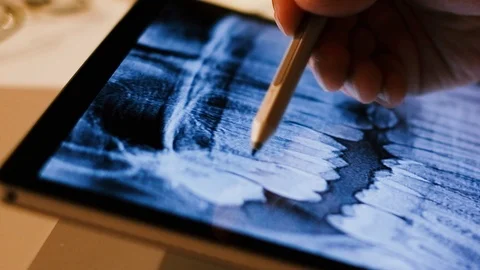 Doctor analyzing medical data on touchscreen computer Stock Footage 93623707