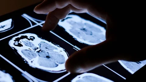 Doctor analyzing medical data on touchscreen computer 스톡 동영상 93623736