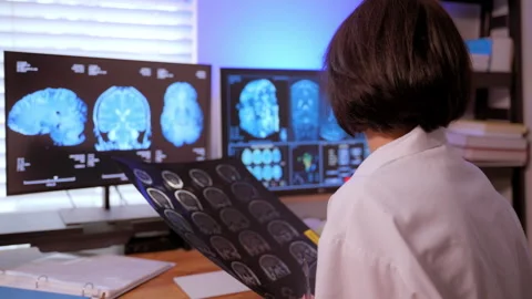 The doctor analyzing a patient's MRI scan to diagnose brain conditions and plan Stock Footage 304295897