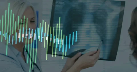 Doctor analyzing X-ray with data visualization animation over medical background Stock Footage 304257160