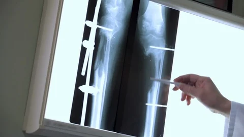 Doctor analyzing x-ray. Stock Footage 100598567