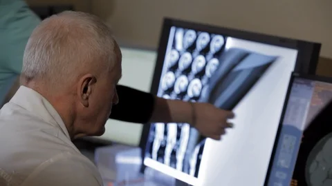 Doctor analyzing x-ray. Stock Footage 100599358