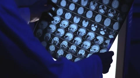 Doctor and MRI Stock Footage 314571876