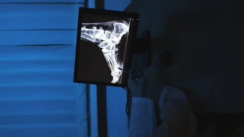 Doctor and X-ray Stock Footage 315213694