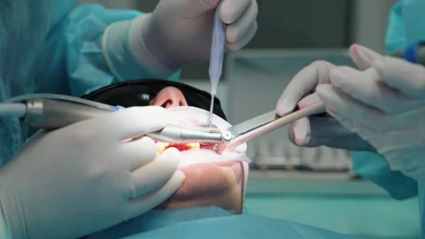 Doctor with an assistant is treating a patient's teeth. Hands in gloves Video stock 221079971