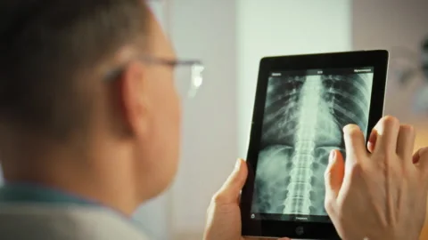 A doctor carefully examines an x-ray of the lumbar spine on an electronic ta Stock Footage 333501430