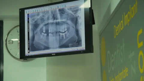 Doctor is checking 3D dental scan for future implant Stock Footage 105571032