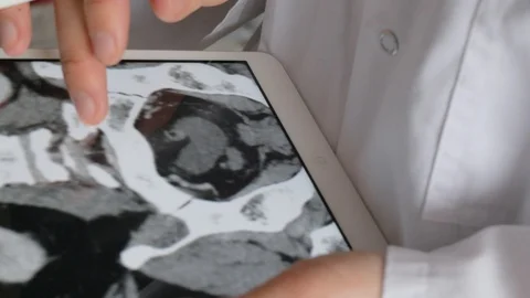 Doctor checking computed tomography of the abdominal cavity Stock Footage 87517718