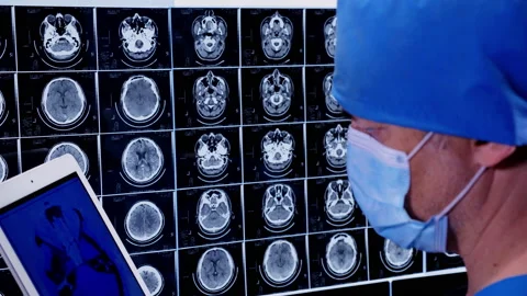 Doctor checking MRI  Stock-Footage 196155033