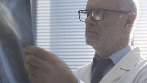Doctor checking a patient's radiograph of rib cage Stock Footage 127368606