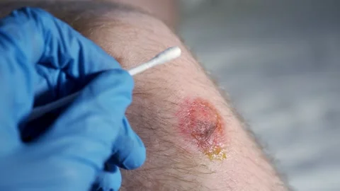 Doctor checking wound on knee. Close up shot Video stock 131102676