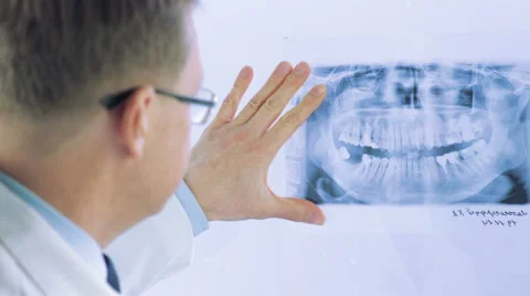 Doctor checking X-Ray Stock Footage 56466820