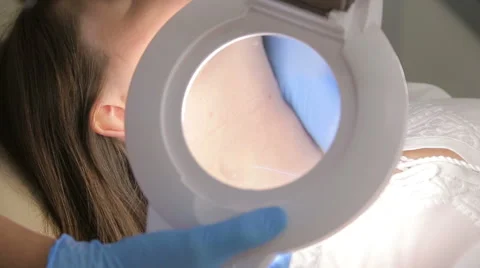 Doctor conducting operation to remove papillomas Stock Footage 67388729