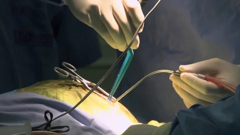 Doctor conducting Surgery Stock Footage 123719756