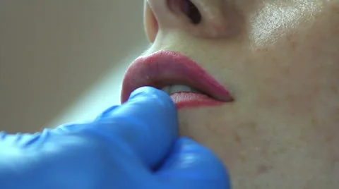 Doctor Corrects Lip Stock Footage 65990383