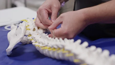 Doctor demonstrating how a spinal cord stimulation works Stock Footage 113483077