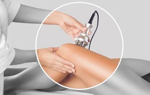 The doctor does the Rf lifting procedure on the legs, buttocks and hips of .. Stock Photos