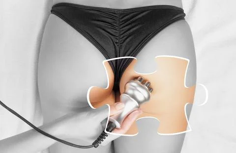 The doctor does the Rf lifting procedure on the legs, buttocks and hips of .. Stock Photos