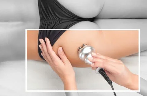 The doctor does the Rf lifting procedure on the legs, buttocks and hips of .. Stock Photos