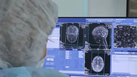 The doctor is doing an MRI of the brain. High-tech medical equipment. Stock Footage 164675456