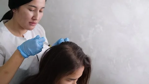 Doctor is doing a plasma therapy injecting head for healthy hair growth Stock Footage 319294782