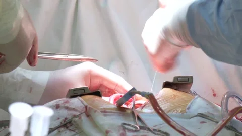 Doctor doing surgery in modern operating room Video stock 237212997