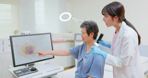 Doctor exam mole with microscope Vidéo 244308735