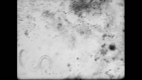 Doctor Examines Hookworm Parasite Sample Under Microscope 스톡 동영상 130723592