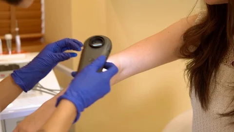 The doctor examines the mole of the patient using a Dermatoscope. dermatologist Stock Footage 93095413