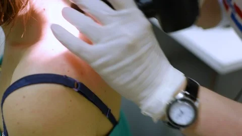 The doctor examines the patient's mole Stock Footage 76126150
