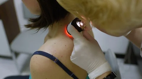 The doctor examines the patient's mole Stock Footage 76126524
