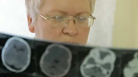 Doctor examines an x-ray Stock Footage 12355194