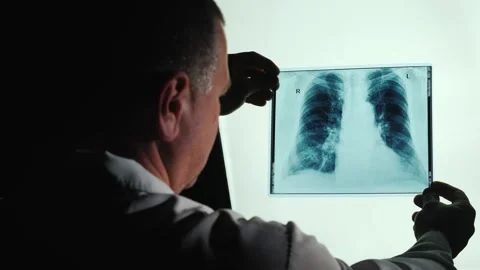 Doctor examines x-ray of human lungs doctor looks at the x-ray of the lungs.. Stock Footage 334705631