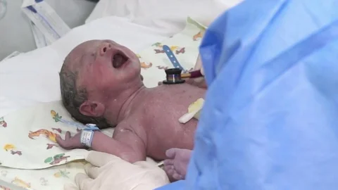  Doctor examing newborn Stock-Footage 72682471