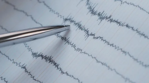 Doctor Examining Electroencephalogram Stock Footage 116310336