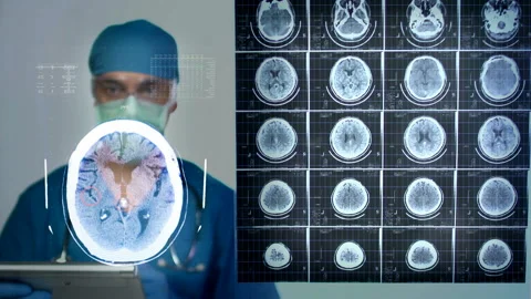 Doctor Examining An Mri Video stock 210517565