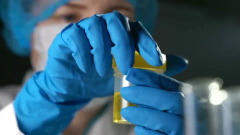 Doctor examining an urine sample Stock Footage 105854406